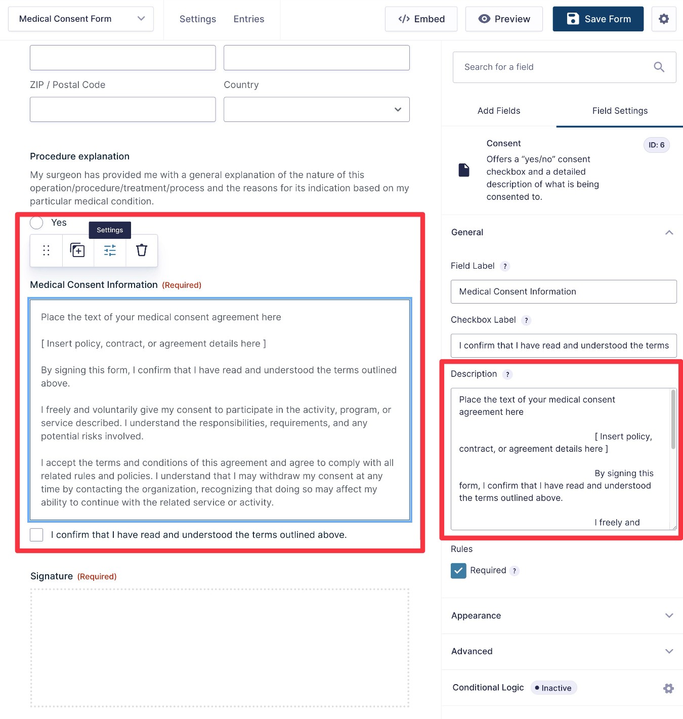 Adjust the consent agreement